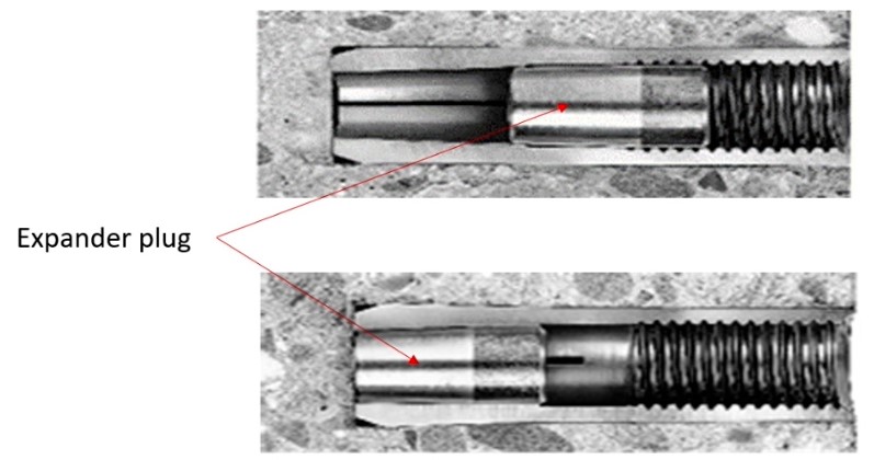 Concrete screws vs wedge anchors vs throughbolts: what's the difference?